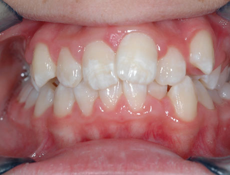 Orthodontics