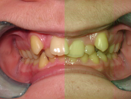 Orthodontics